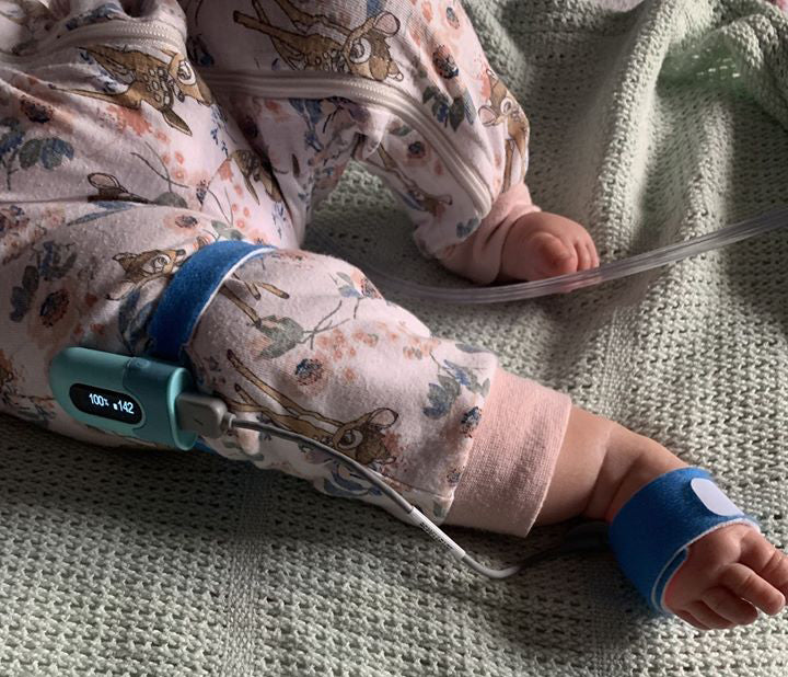  BabyO2 - Monitor de oxígeno para bebé (para colocarlo en el  pie), con alarma en la aplicación, con seguimiento de nivel de O2 y  frecuencia cardíaca; monitor de saturación de oxígeno