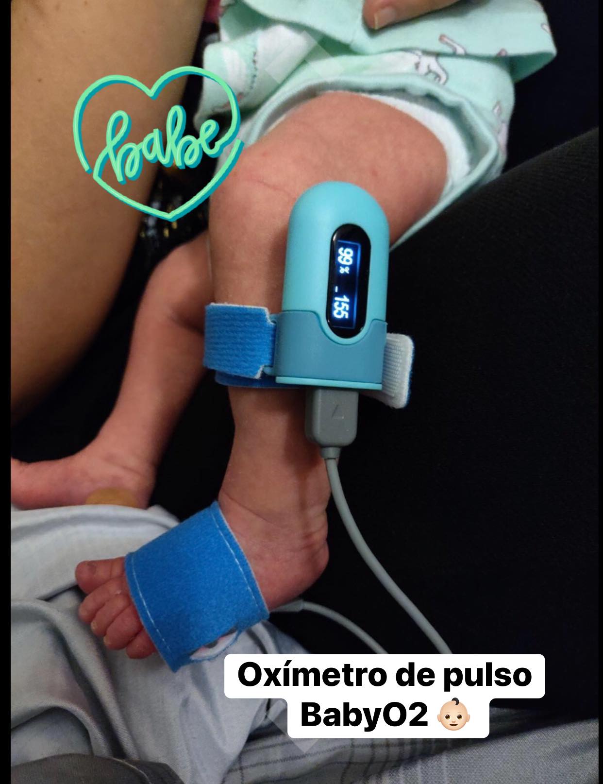 Oxímetro de pulso BabyO2